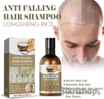 Rice Water Hair Care Shampoo – Hair Fall Control, Dandruff Removal, Vo photo 5
